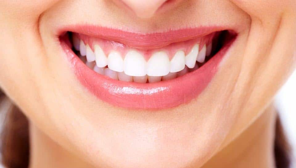 Beautiful smile from cosmetic dentistry